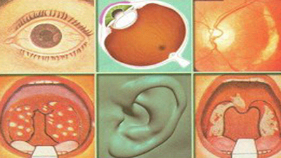 ENT, DENTISTRY AND OPHTHALMOLOGY